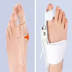 Ayarlanabilir Ayak Baş Parmak Kemik Düzeltici – Halluks Valgus (Bunyon) Aparatı, Gece Gündüz Kullanıma Uygun Ayak Düzeltme Ateli (4745)-3
