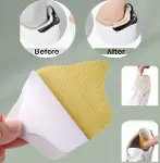 Taç Şekilli 5 mm Topuk Daraltma ve Vurma Önleyici (4745)-2