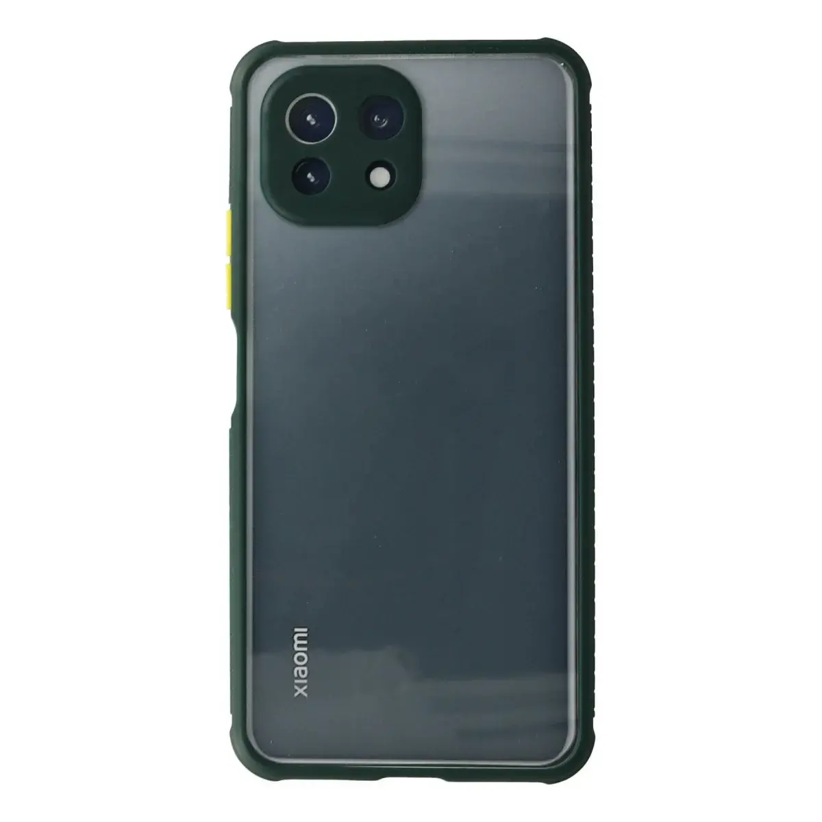 Xiaomi Mi 11 Lite Kılıf Miami Şeffaf Silikon - Koyu Yeşil
