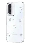 Samsung Galaxy A36 Fiyonk Desenli Kapak - Desen 5-3