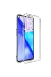One Plus 9 Pro Kılıf Lüx Şeffaf Silikon-1