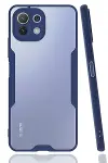 Xiao Mİ 11 Lite Kılıf Platin Silikon - Lacivert-1