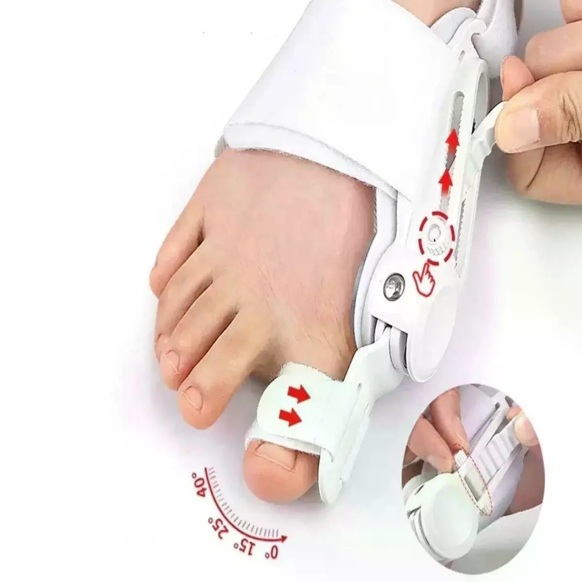 Ayarlanabilir Ayak Baş Parmak Kek Düzeltici – Halluks Valgus (Bunyon) Aparatı, Gece Gündüz Kullanıma