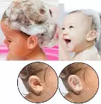 Su Geçirmez Yapışkanlı Kulak Koruyucu Bant 10 lu Paket-1