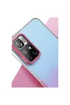 Xiao Red Note 11 Pro Glossy Kapak - Pembe-3