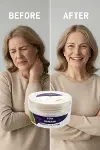 Fıtık Kurutan Krem 50 Ml-1